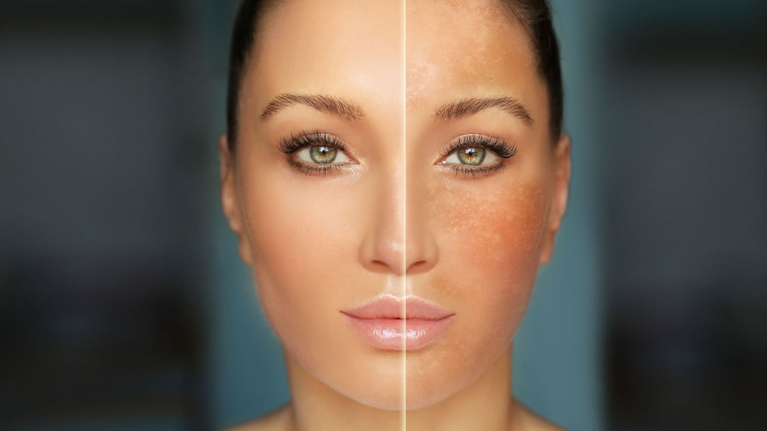 The Invisible Threat: Harmful Effects of UV Radiation
