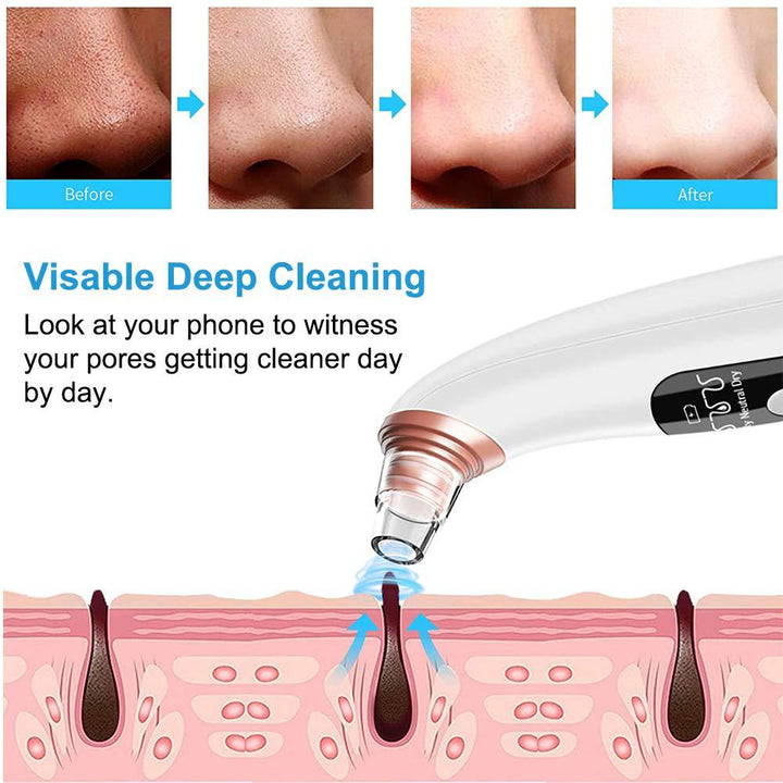 Wifi Blackhead Suction Vacuum Remover with Camera