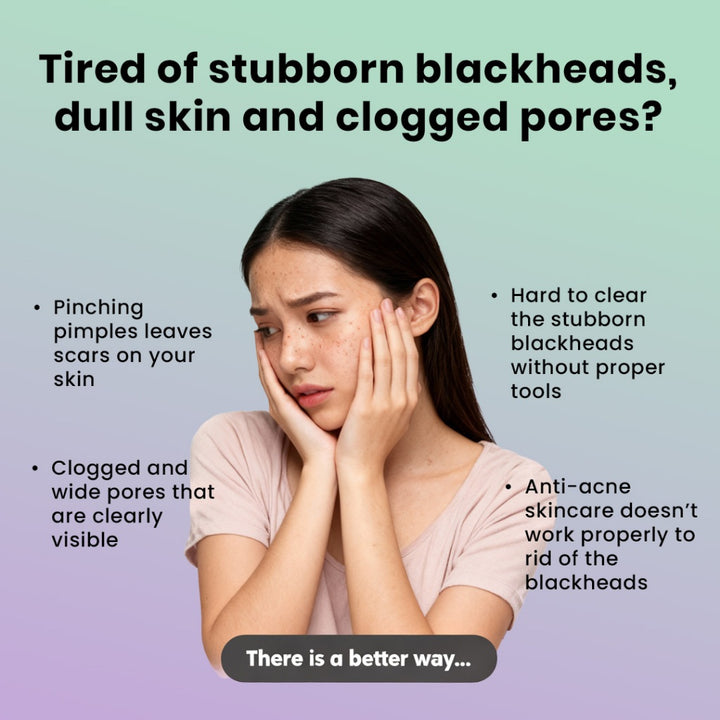 Efreshme Ultrasonic Skin Scrubber - Pore Ion Cleaner Facial Exfoliation Blackhead Whitehead Pimple Remover