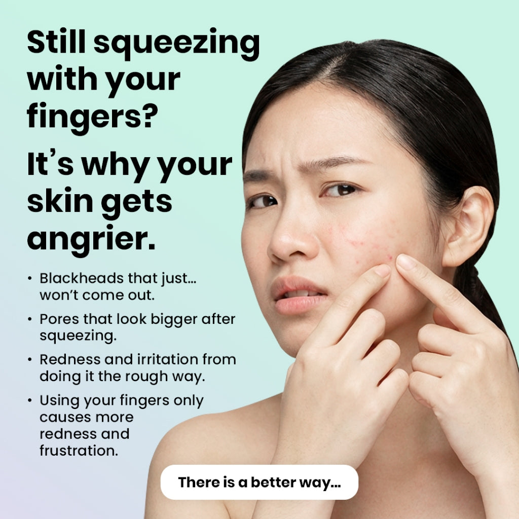 Efreshme Precision 8 Pcs Blackhead Remover Tool Set with Case; Extractor, Tweezer, Pimple, Acne, Whiteheads, Acne