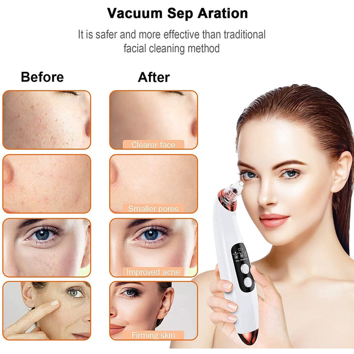Blackhead Suction Vacuum Facial Pore Deep Cleaning Comedone Tool USB Rechargeable - Bubble + Blue Light Beauty efreshme   