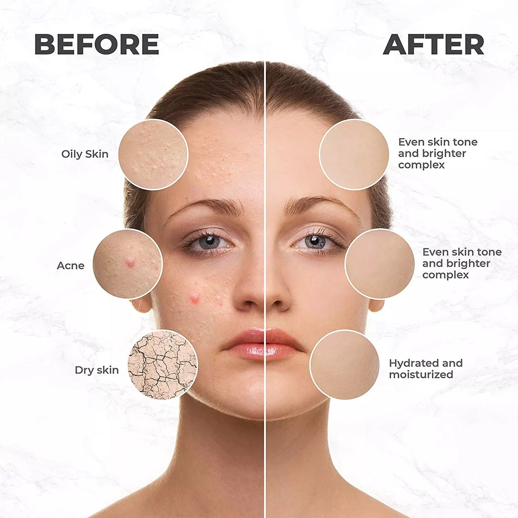 Facial Ice Globes Stainless Steel Rollers for Cryo Massage Beauty Efreshlab   